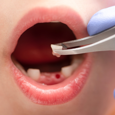 Dental Implants & Cosmetic Dentistry